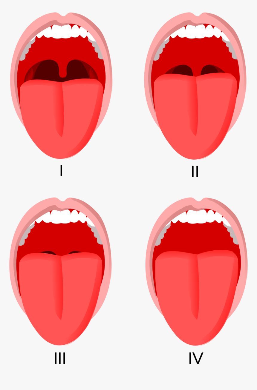 Mallampati, HD Png Download