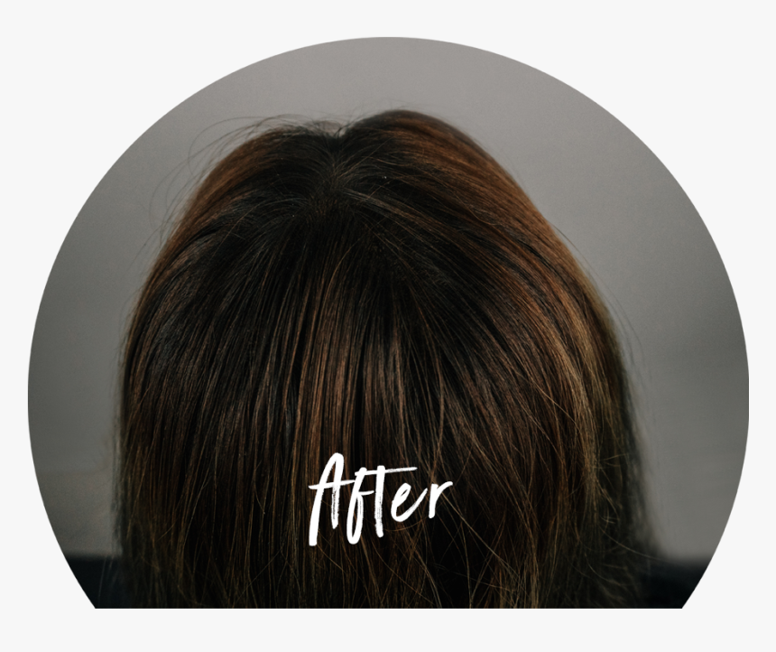 Hairsecret-360 After - Lace Wig, HD Png Download