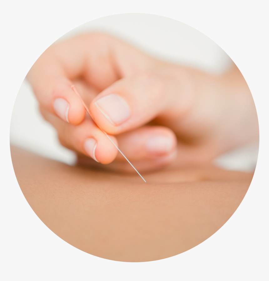 Acupuncture - Acupuncture Transparent, HD Png Download