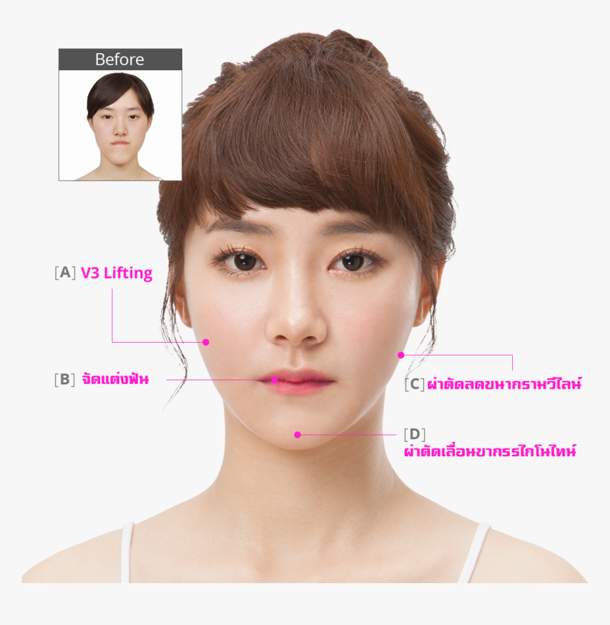 #hospital Healthy Happy Face Plastic Surgery, HD Png Download