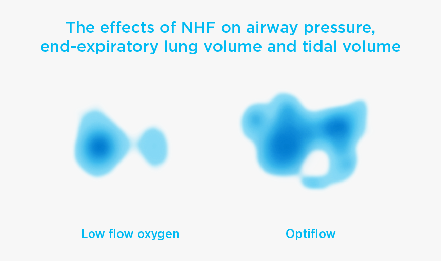 Optiflow High Flow Pressure Mechanism Overview - Teddy Bear, HD Png Download