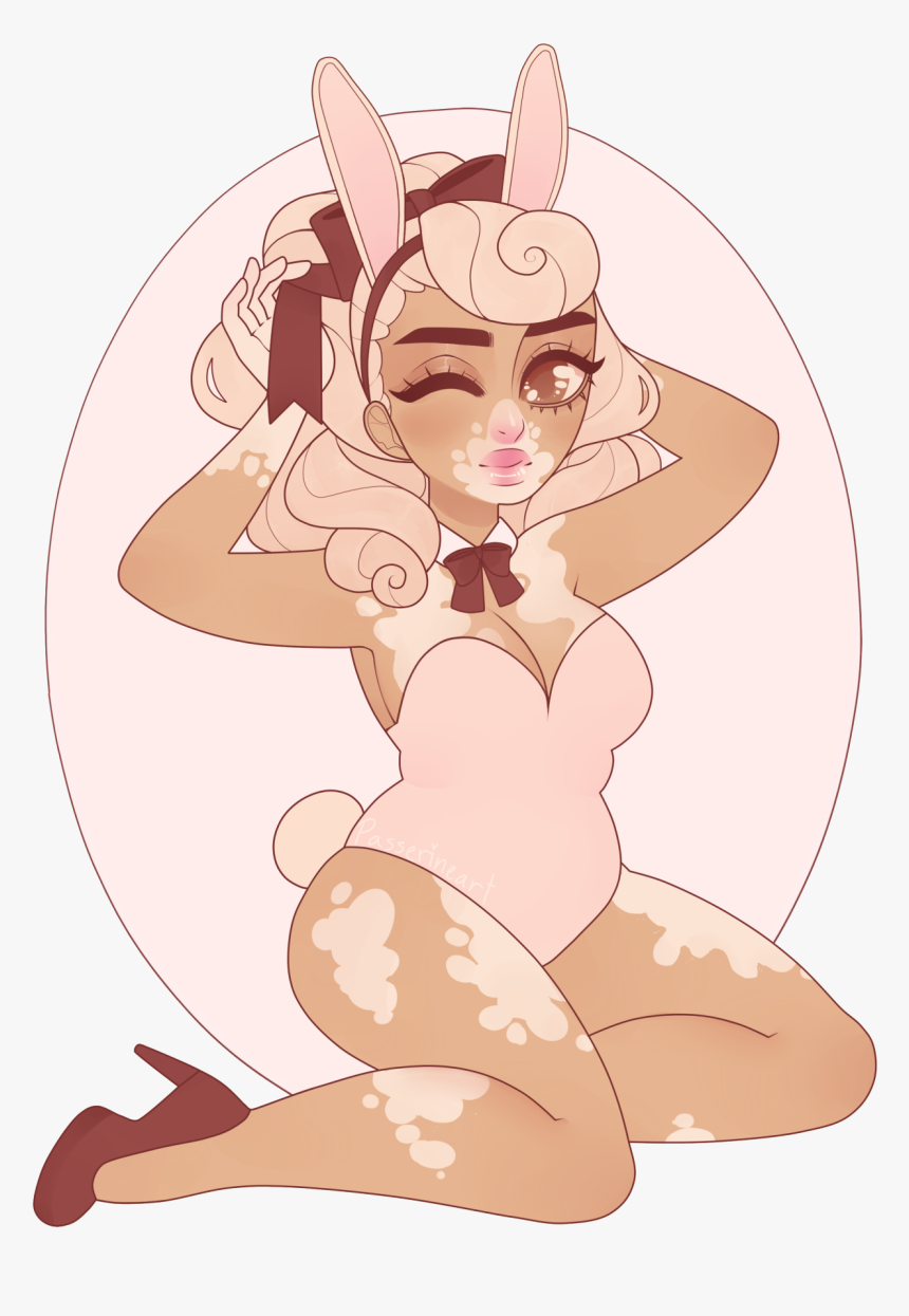 Anime Vitiligo Art, HD Png Download