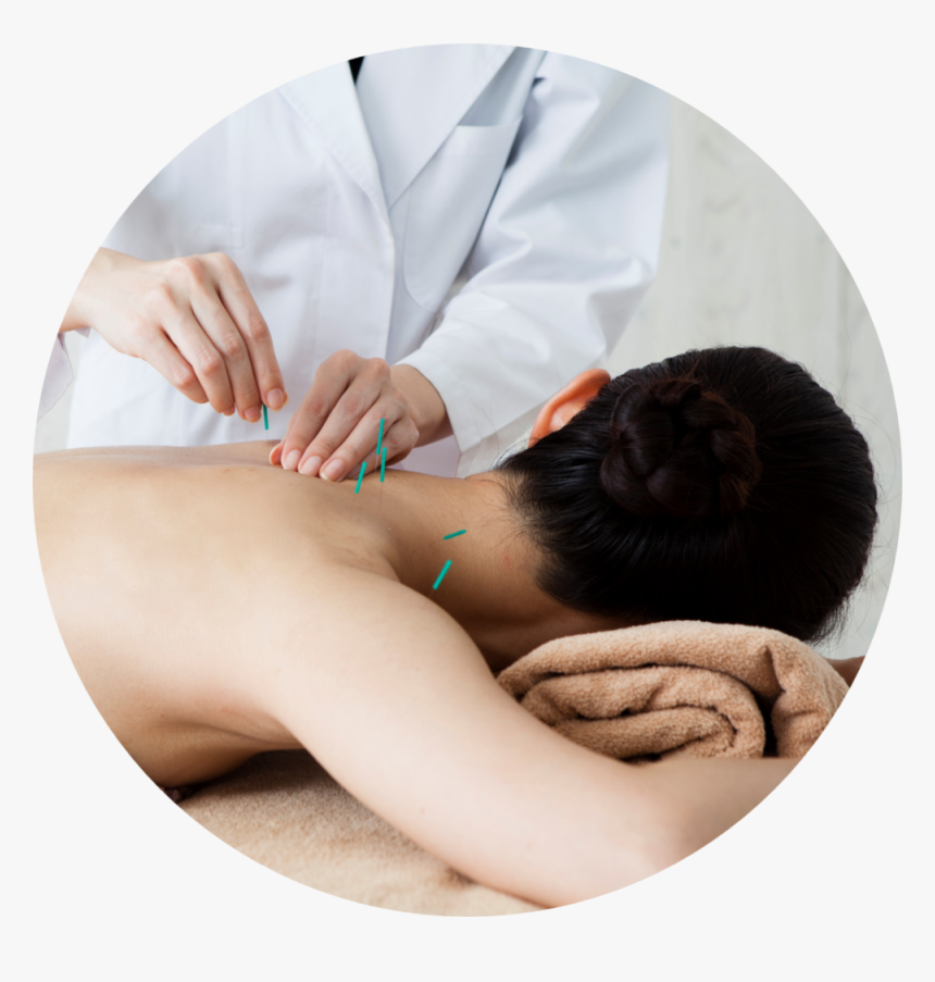 Acupuncture1 - Fisioterapia Em Acupuntura, HD Png Download
