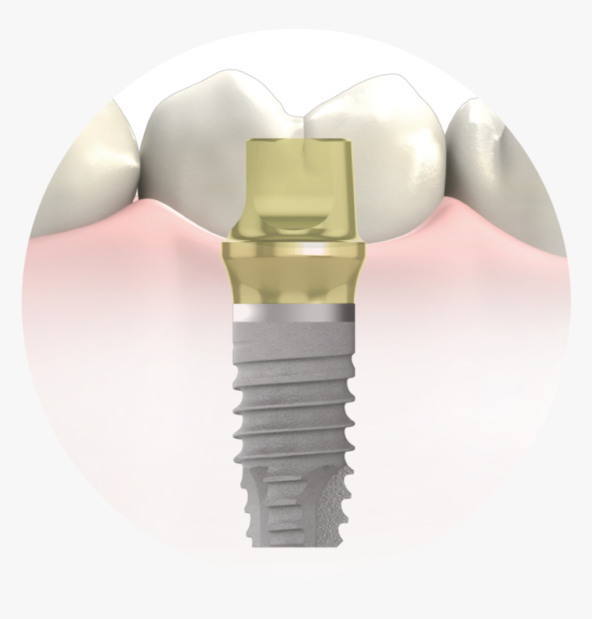 Dental Implant Procedures In Manhattan - Circle, HD Png Download