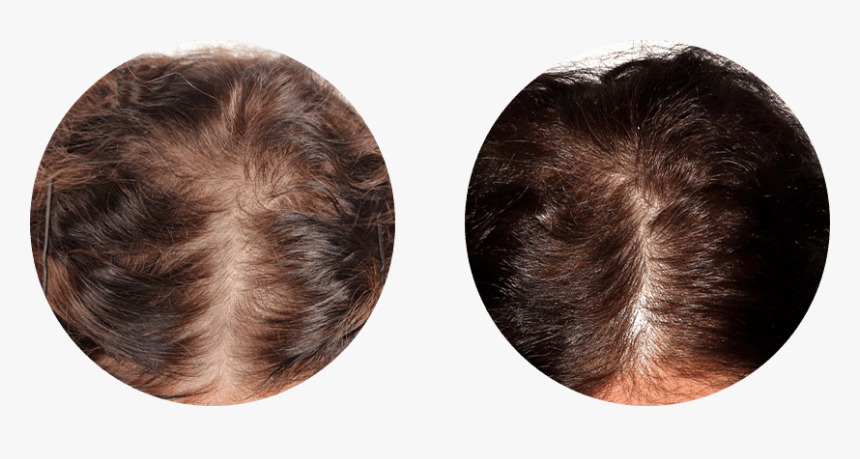 Lace Wig, HD Png Download