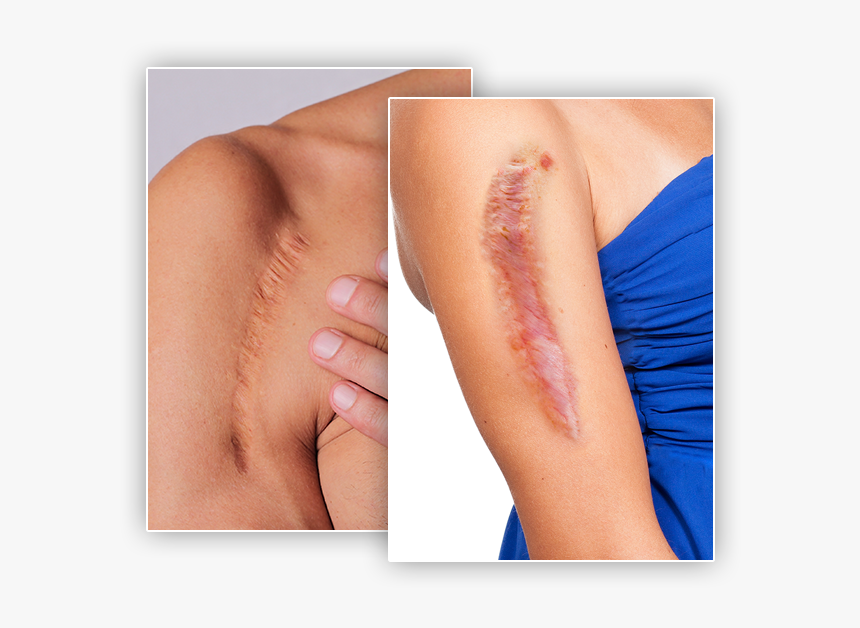 Tattoo, HD Png Download