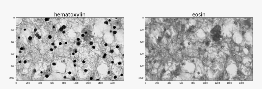 / Images/examples Nuclei-segmentation 7 0 - Circle, HD Png Download