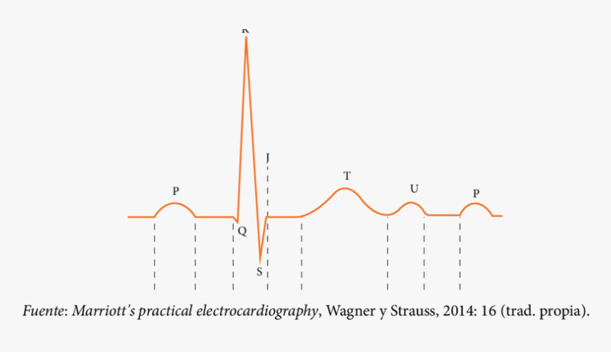 Ondas Del Ciclo Cardiaco, HD Png Download