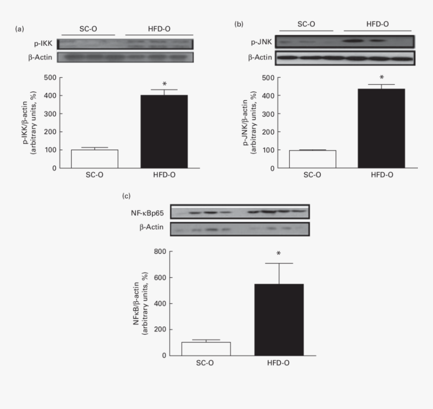 Liver High Fat Diet Ikb, HD Png Download