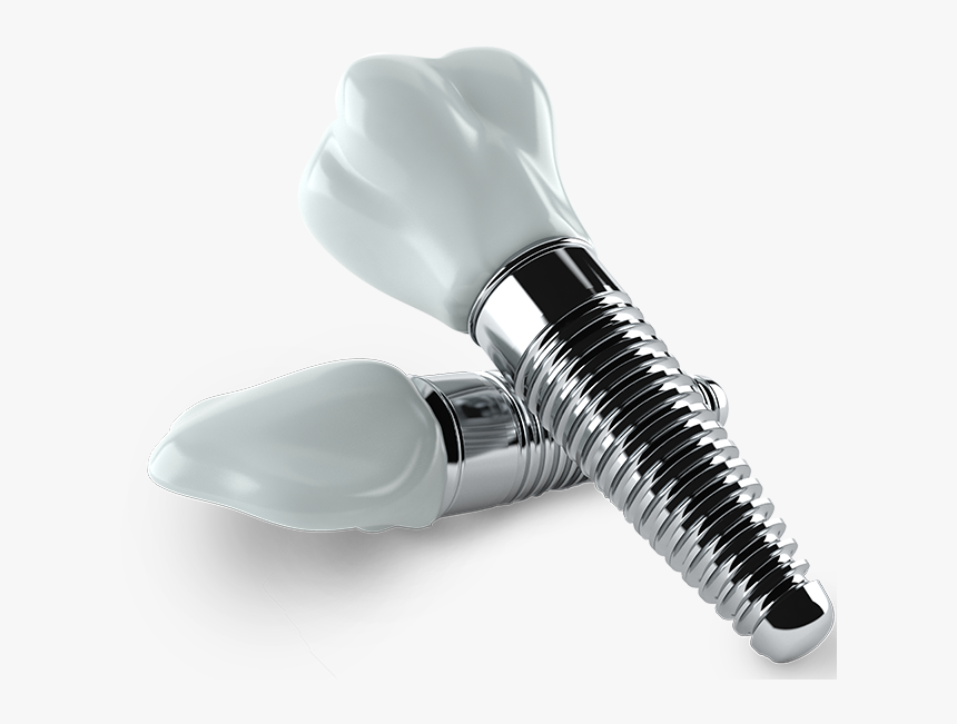 Dental Implants - Dental Implants Png, Transparent Png