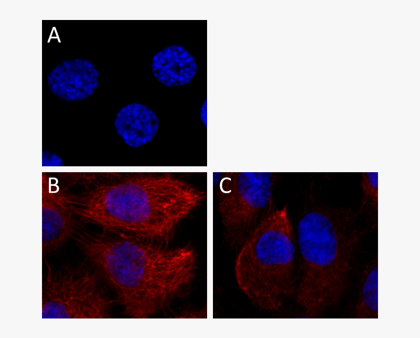 W16155a A647 Cytokeratin-7 Icc - Circle, HD Png Download