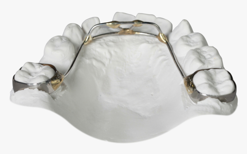 Orthodontics, HD Png Download