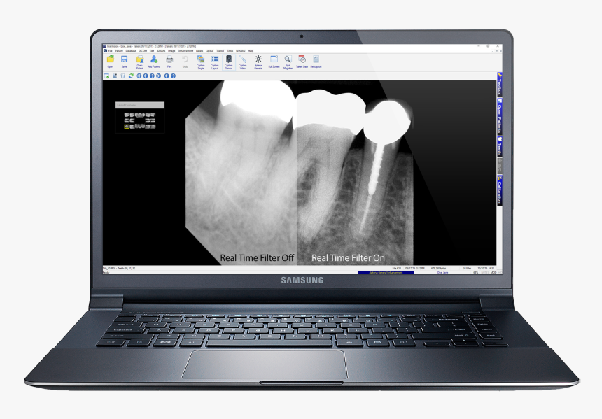 Laptop Mockup Png, Transparent Png