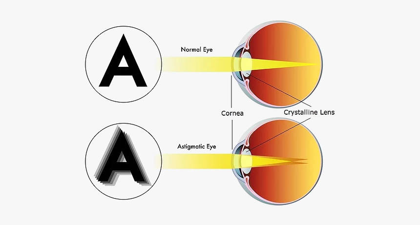 Astigmatism See, HD Png Download