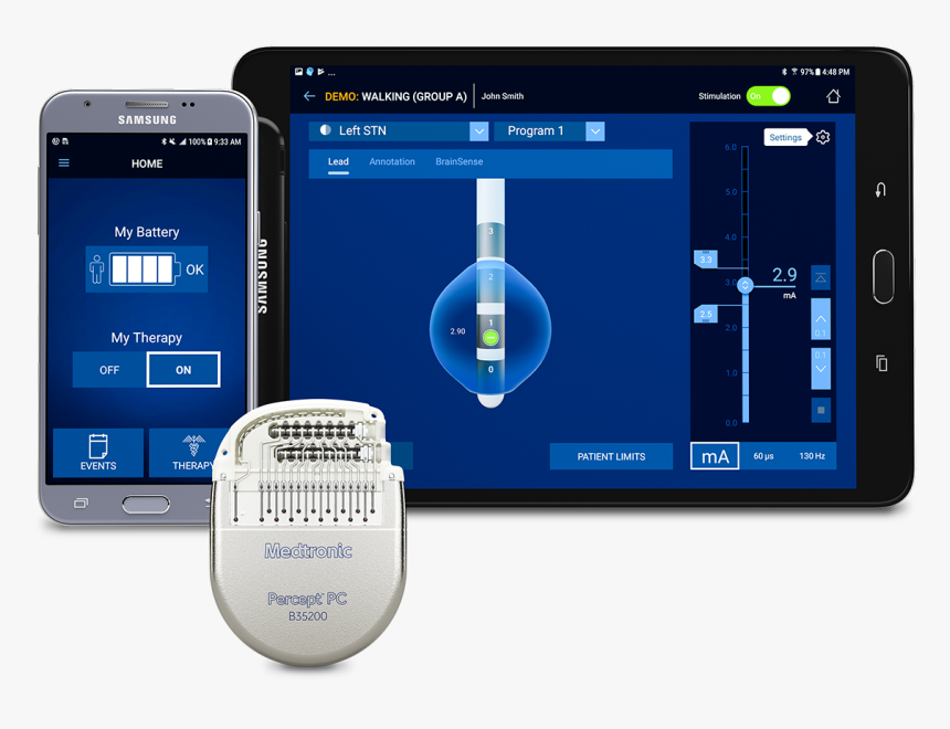 Deep Brain Stimulation, HD Png Download