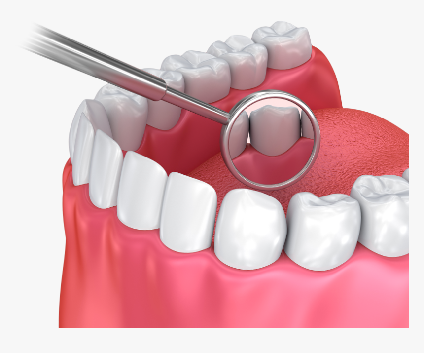 Illustration Of Dental Mirror And Teeth - Steel, HD Png Download