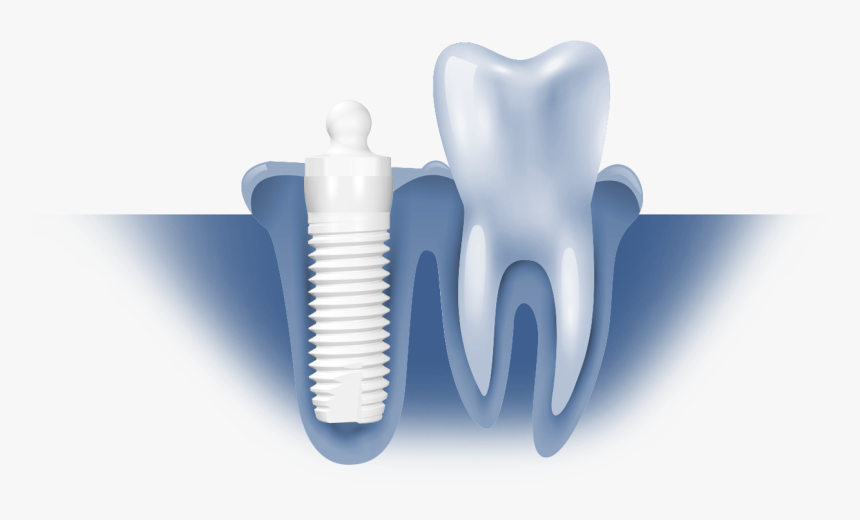 Z5mlb/z5mlb Ceramic Dental Implant By Z-systems - Chair, HD Png Download