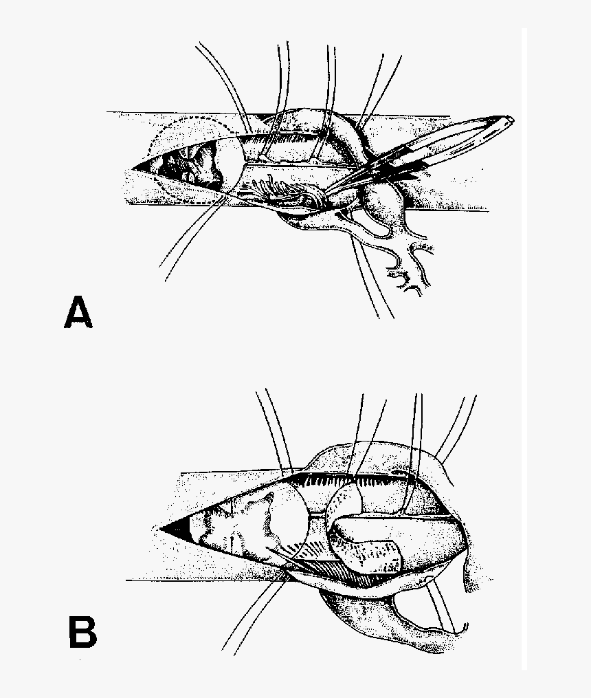 Insect, HD Png Download