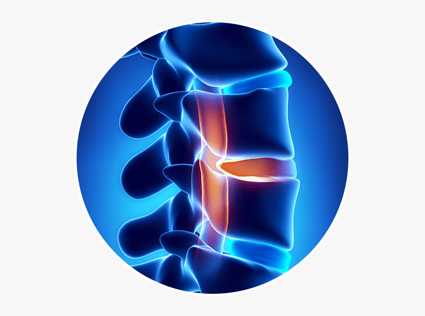 Head And Spine Surgery, HD Png Download