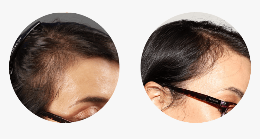 Lace Wig, HD Png Download