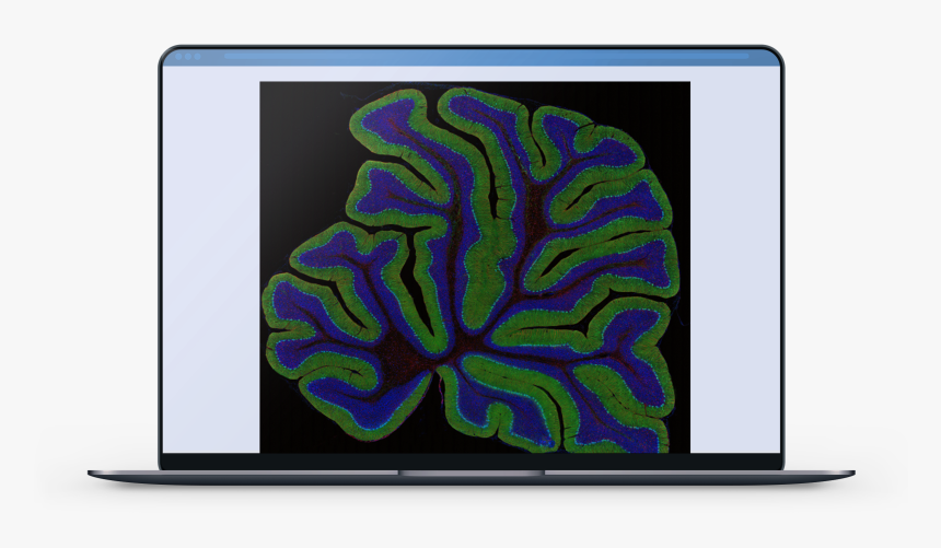 Cerebellum, HD Png Download