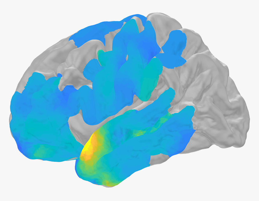 Nih Scientists Showed How Electrical Brain Waves, Called - Human Brain, HD Png Download