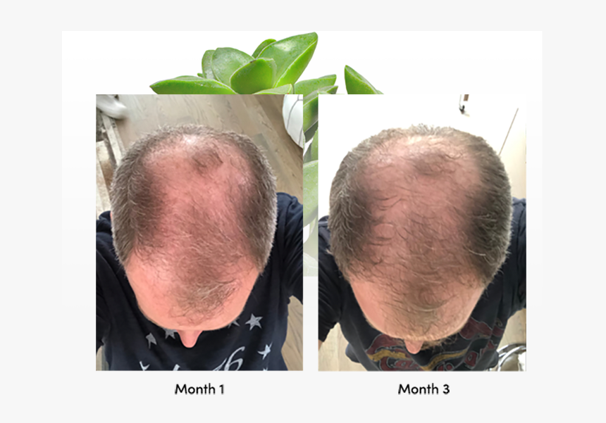 Buzz Cut, HD Png Download