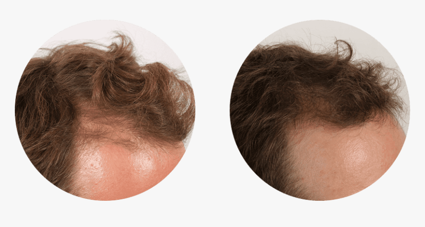 Lace Wig, HD Png Download