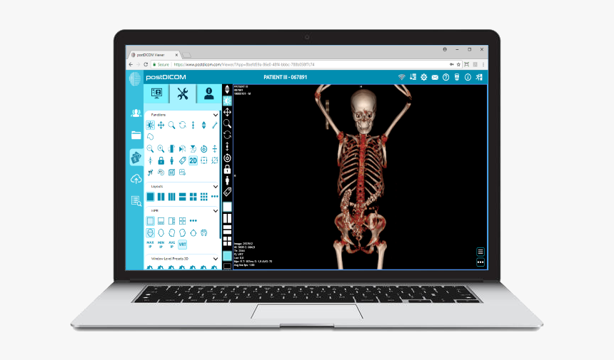 Notebook - Netbook, HD Png Download