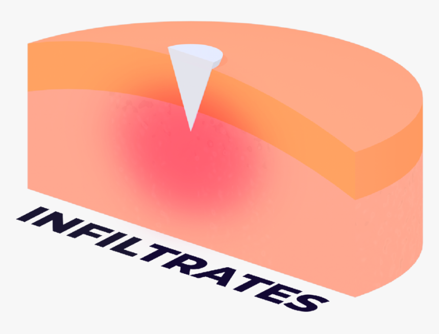 Infiltrates The Zit - Graphic Design, HD Png Download