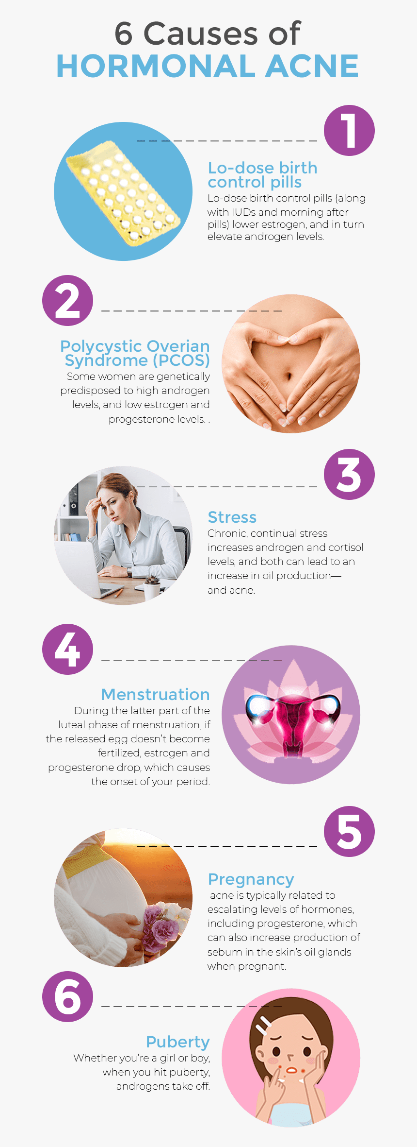 6 Causes Of Hormonal Acne Infographic Androgen Acne HD Png Download 