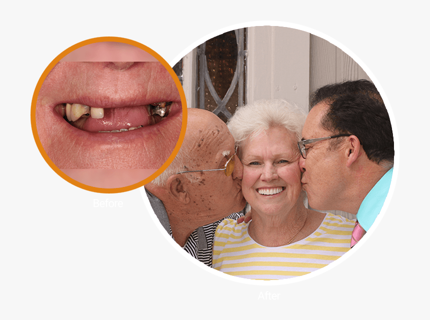 Extreme Close-up Of Sue S Smile And Then Next To It - Fun, HD Png Download