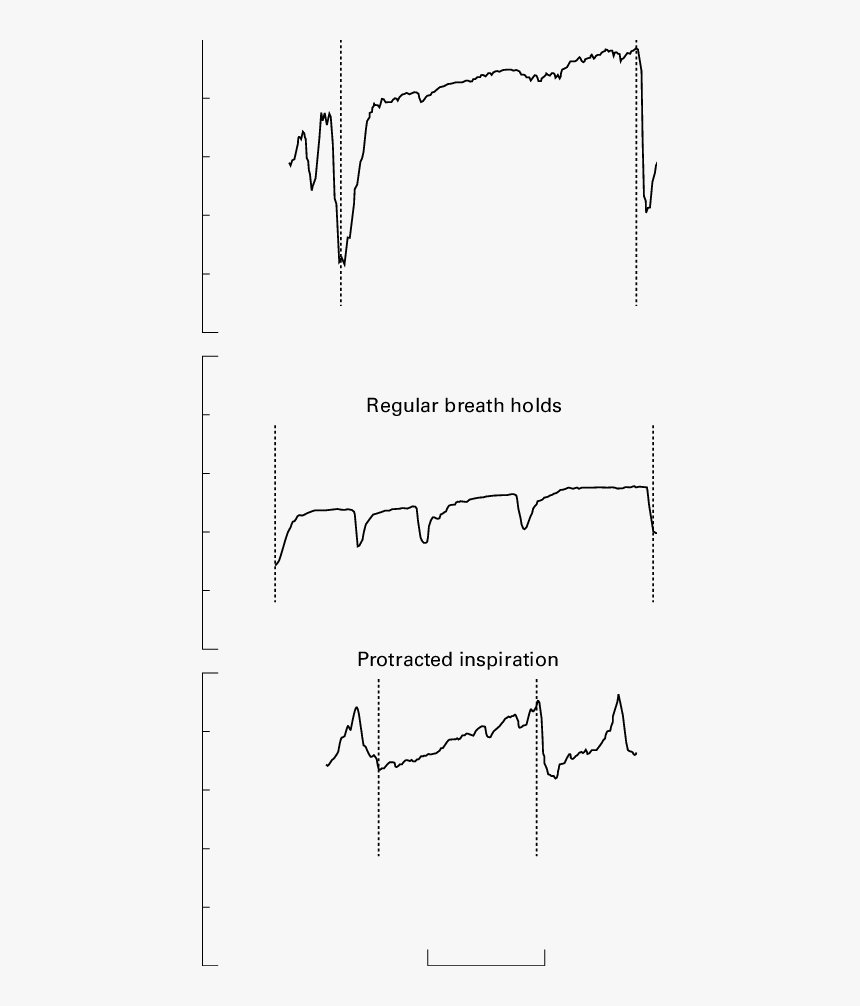 Diagram, HD Png Download