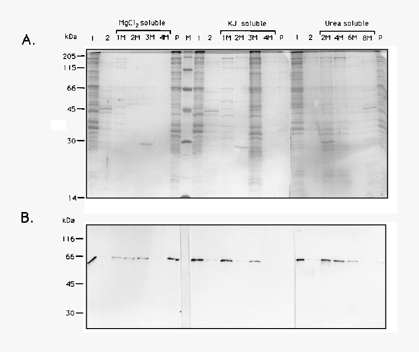 Silver-stained Sds 12% Polyacrylamide Gel Of Triton - Architecture, HD Png Download