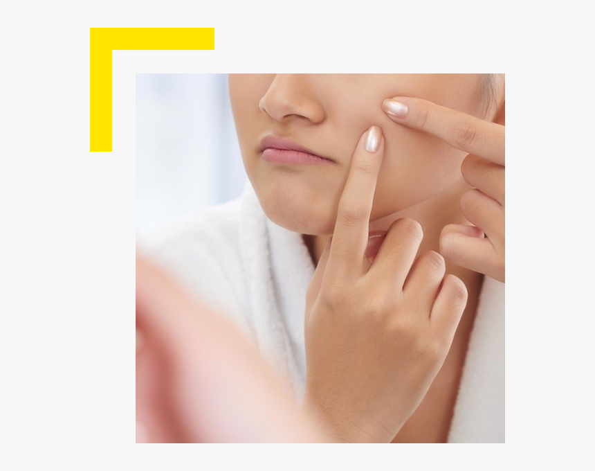 Woman Popping Pimple, HD Png Download