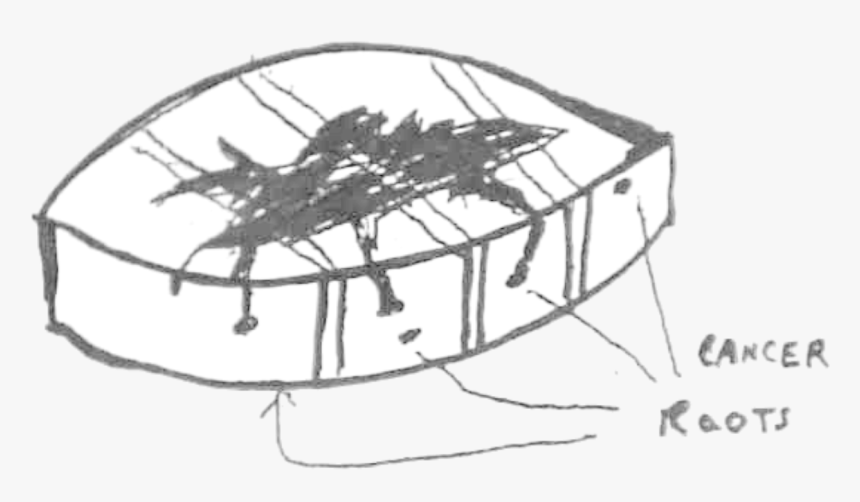 Breadloafing Of Tumor, HD Png Download