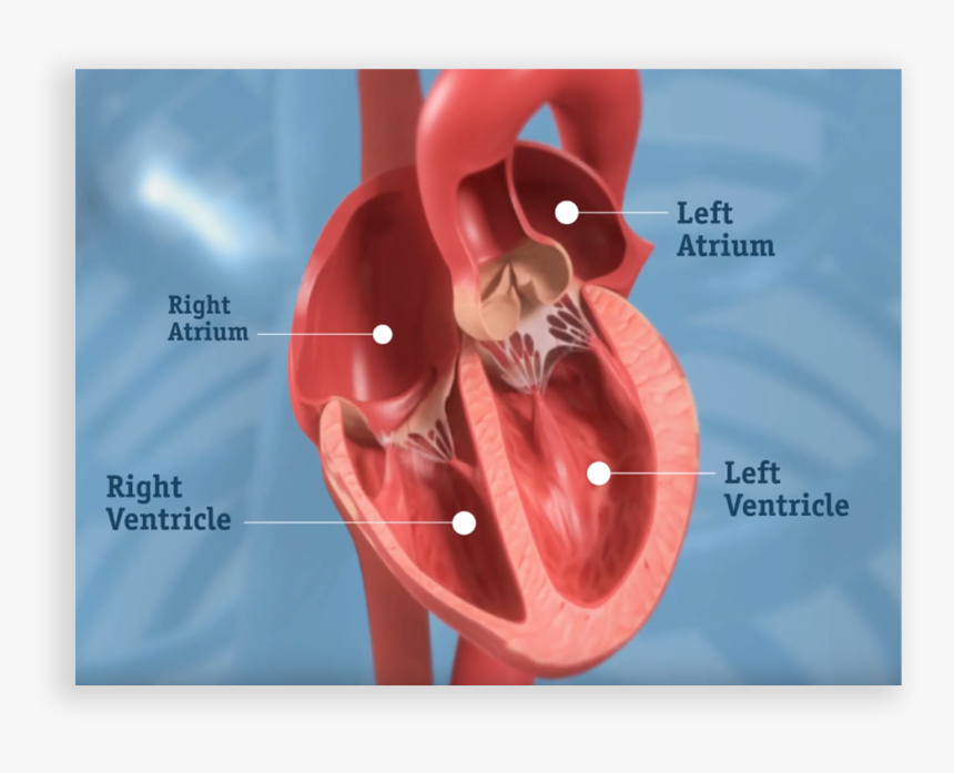 Get More Clarity About Your Dvt Treatment Options - Severe Aortic Stenosis, HD Png Download
