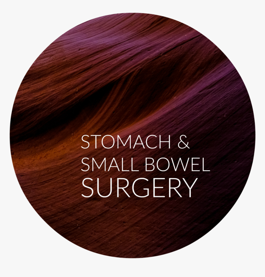 Stomach Sm Bowel - Lace Wig, HD Png Download