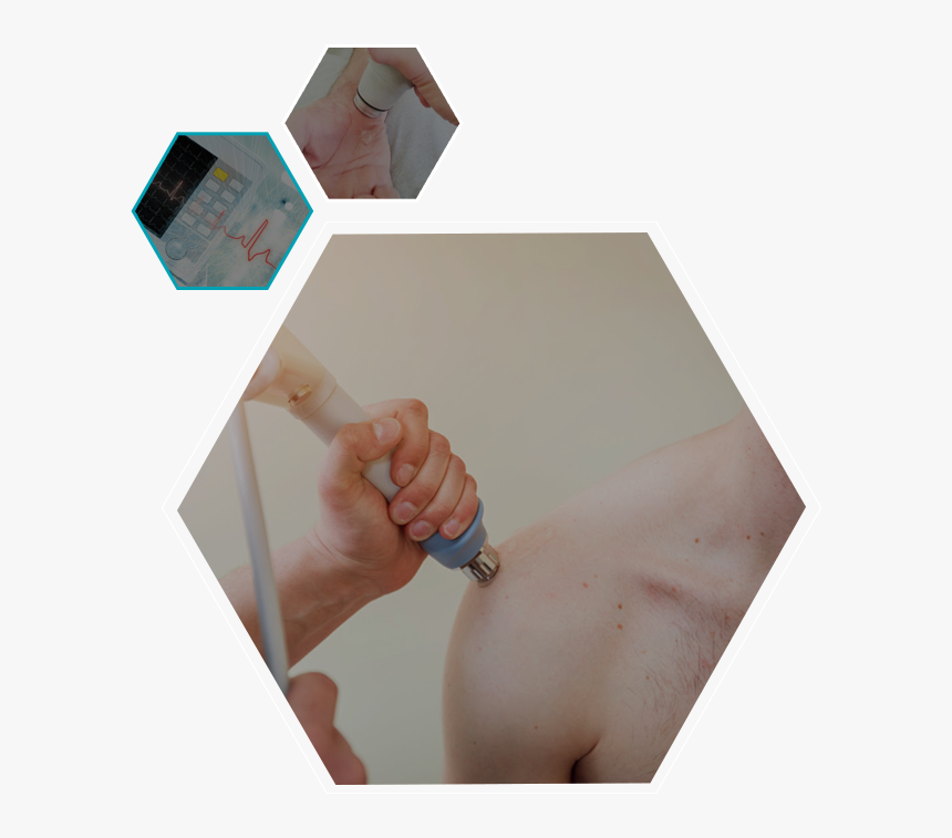 Shock Wave Therapy - Art, HD Png Download