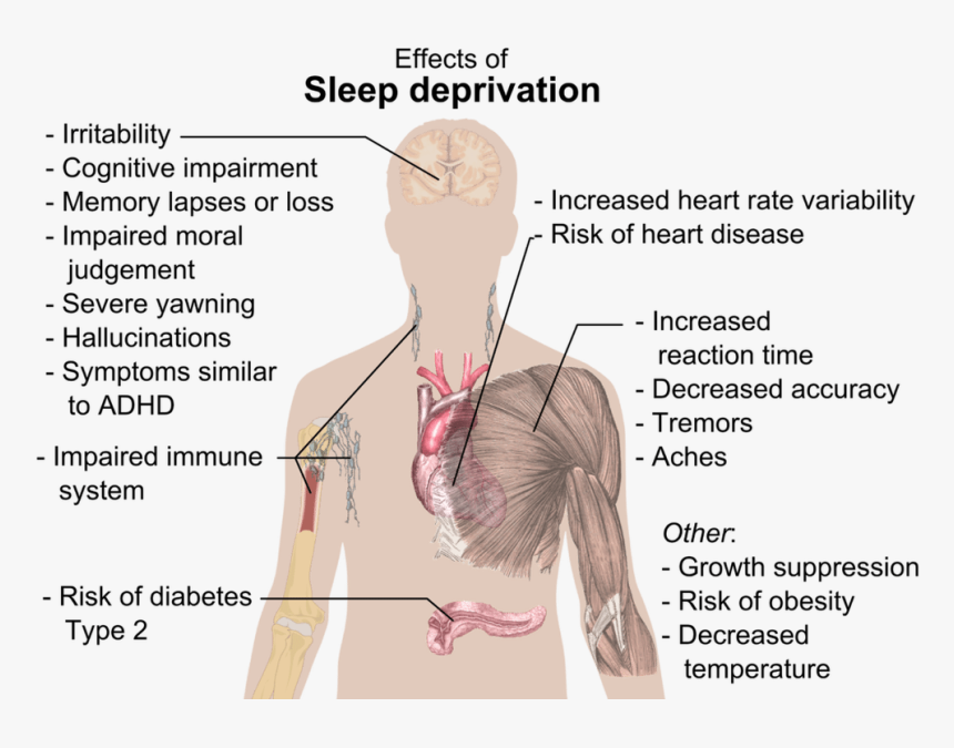 Effect Of Sleep Deprivation - Effects Of Sleep Deprivation, HD Png Download