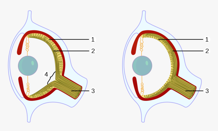 Blind Spot In Eye, HD Png Download