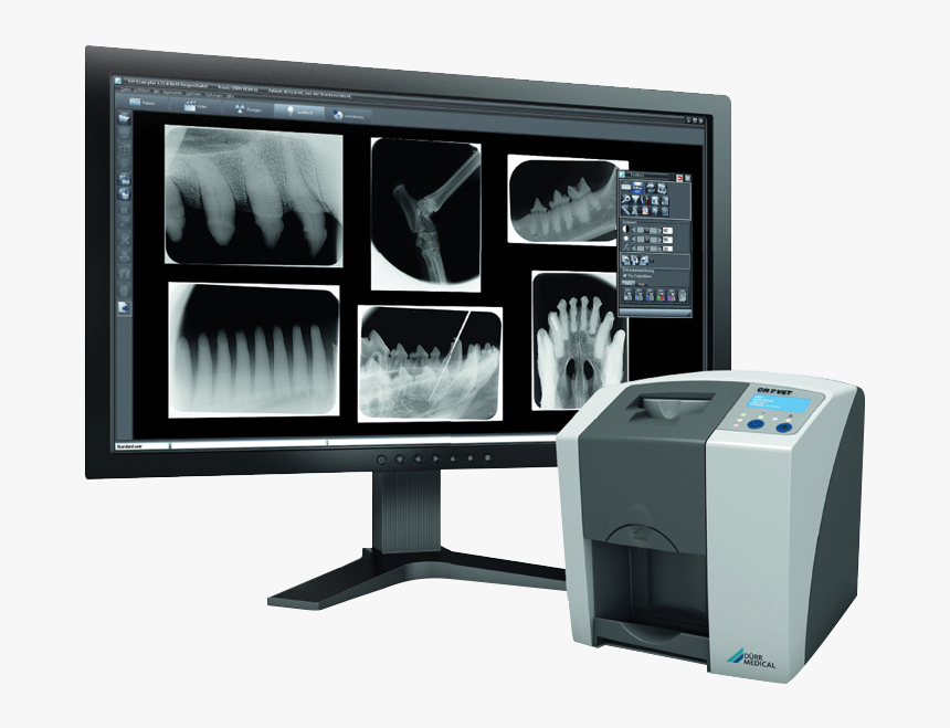 Im3 Cr7 Vet Dental Xray System - Cr7 Im3, HD Png Download