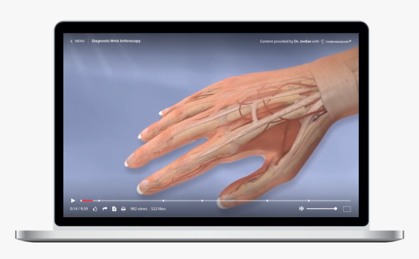 Arthroscopy, HD Png Download