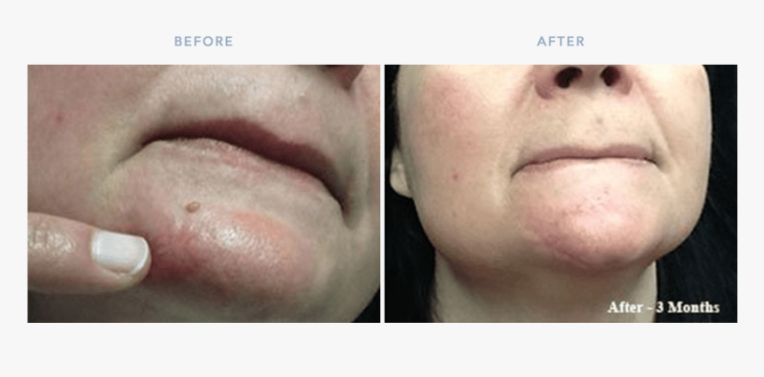 Tongue, HD Png Download