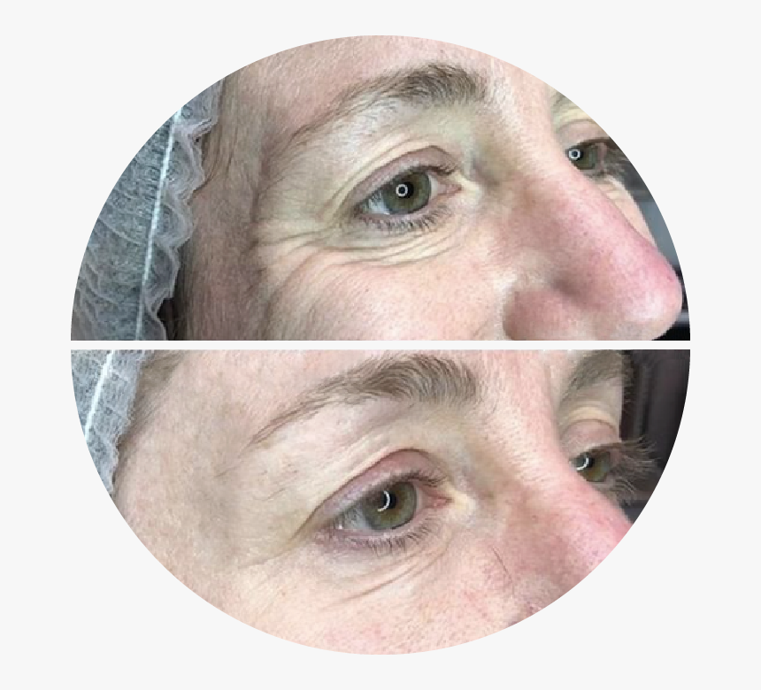 Close-up, HD Png Download