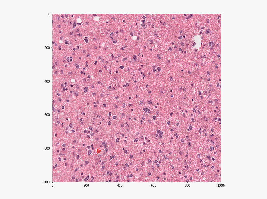 / Images/examples Wsi Io Using Large Image 36 1 - Art, HD Png Download