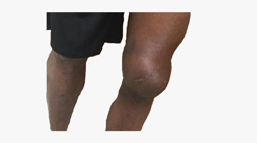 High Quality Knee Grow Blank Meme Template - Tights, HD Png Download