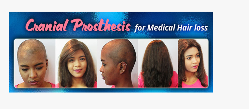 Transparent Bald Man Png - Girl, Png Download