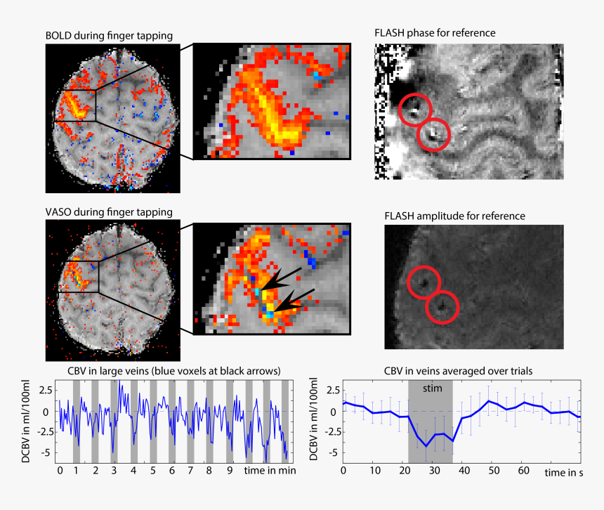 Negative Voxels-01 - Circle, HD Png Download