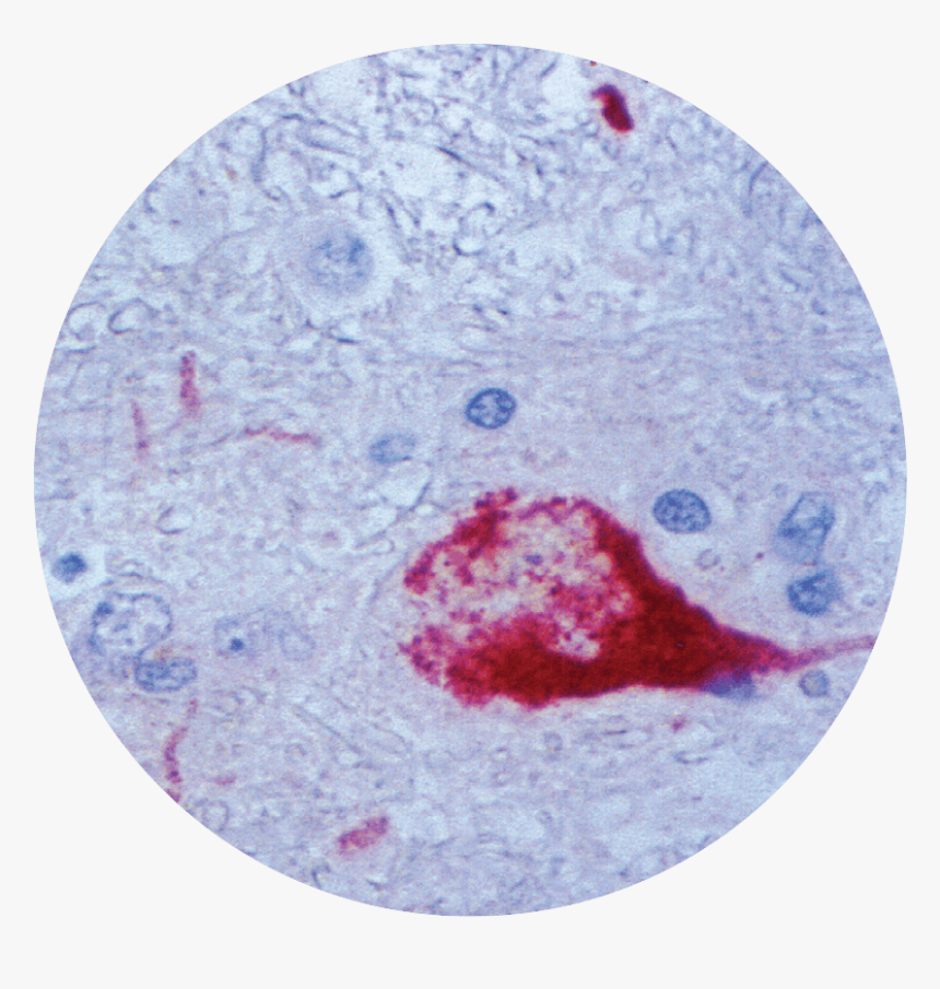 West Nile Virus - Circle, HD Png Download